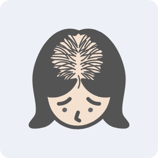 女性型脱毛 イメージ
