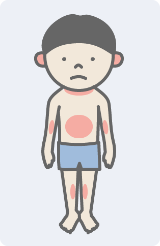 幼児・小児期(1歳~15歳) イメージ