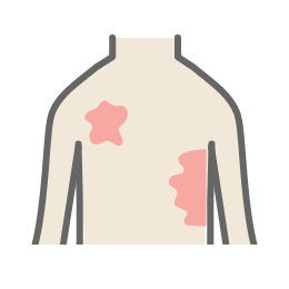 じんましん イメージ