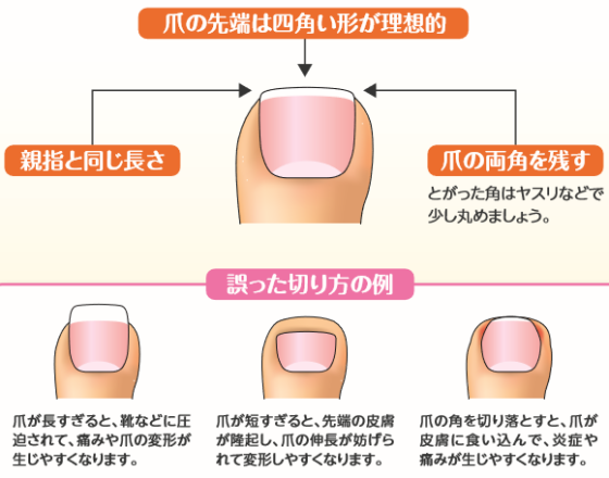 爪の切り方